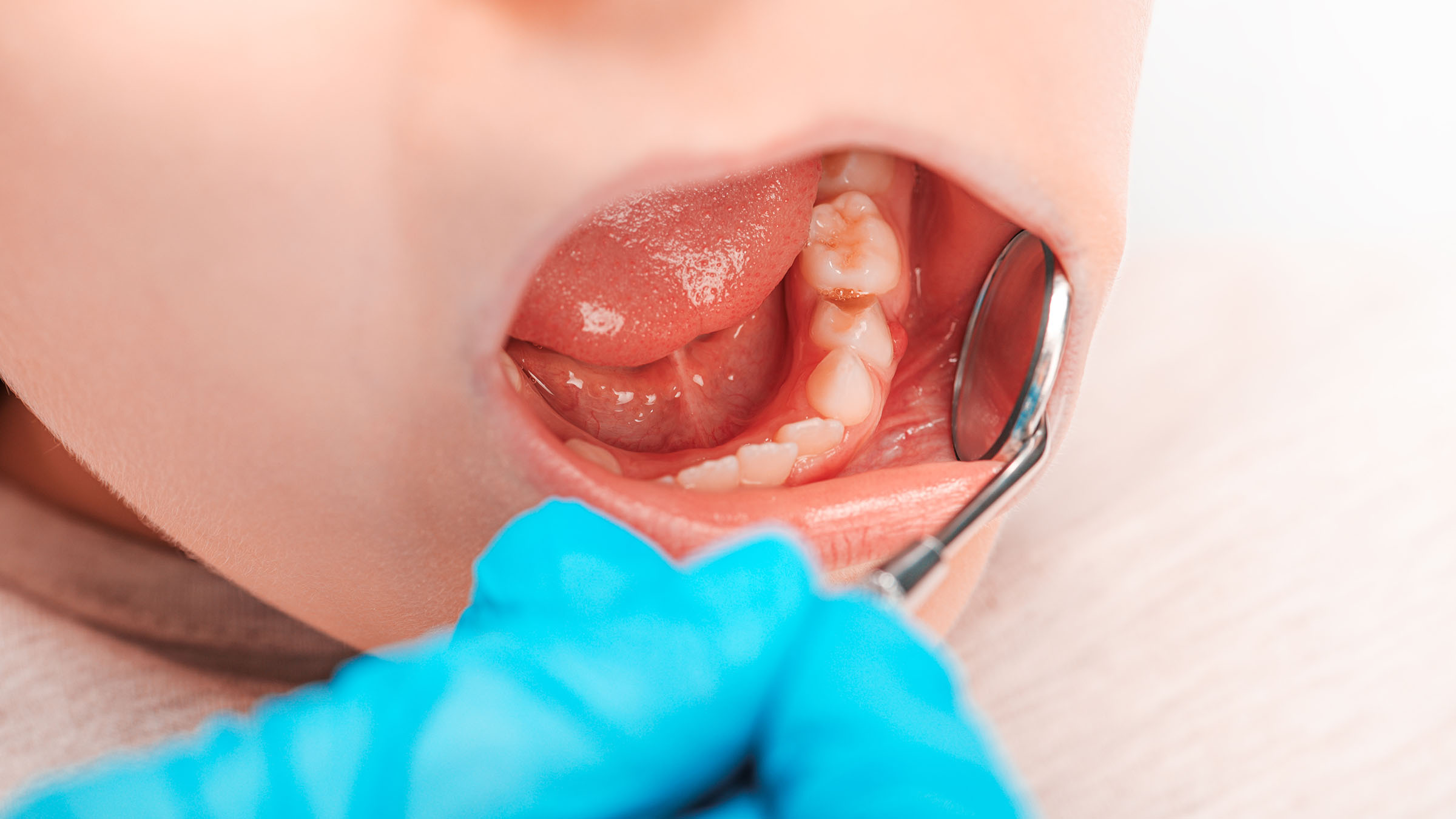 子供の歯科検診イメージ写真